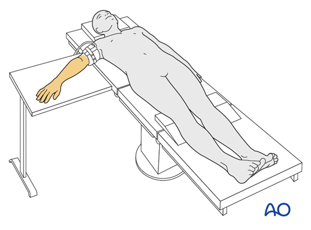 supine for lateral access