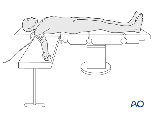 Knowledge Check: When the patient is in the supine position with the arms  at the sides, where should you tuck the draw sheet?…