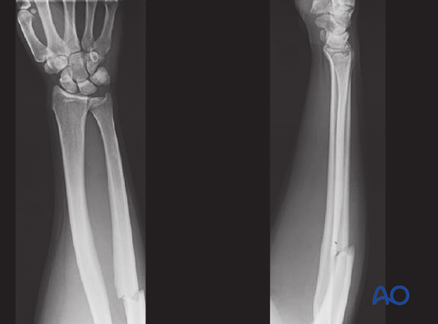 clinical and radiographic examination