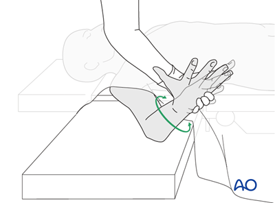 ORIF - Plating of one or both bones for Multifragmentary radial ...