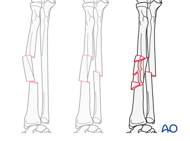 Detailed procedures