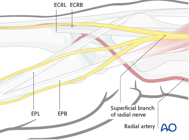 Direct approach to the radial styloid