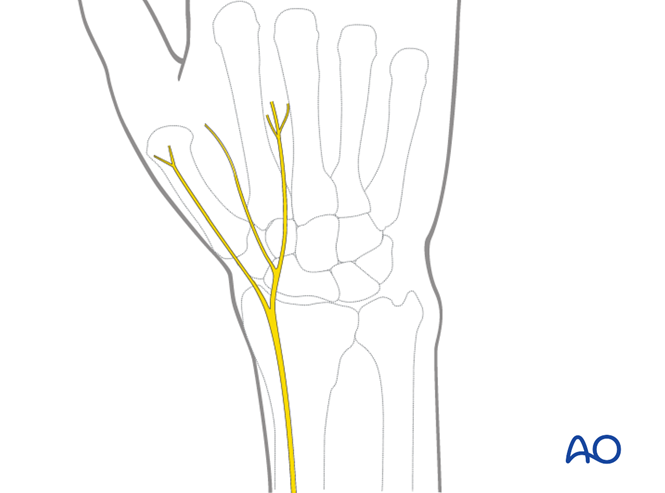 Dorsal approach to the distal forearm for joint spanning plate