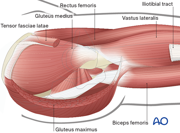 Tensor fasciae latae, gluteus medius, gluteus maximus, vastus lateralis, iliotibial tract, rectus femoris, and biceps femoris