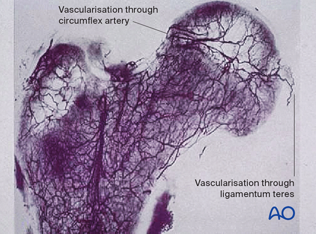 Vascularization of the femoral head through the circumflex artery and the ligamentum teres