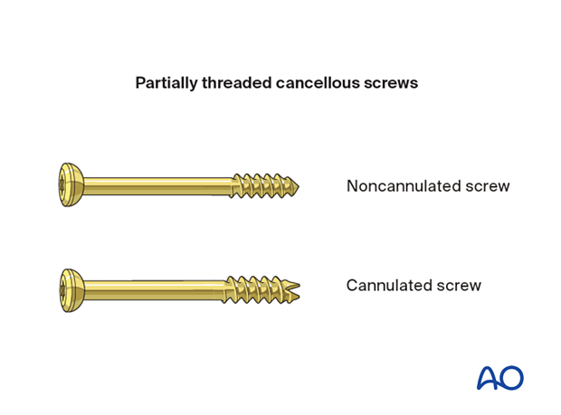 Partially threaded cancellous screws