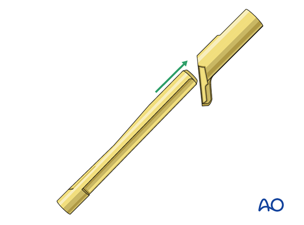 Assembling the bolt in the plate barrel of the femoral neck system