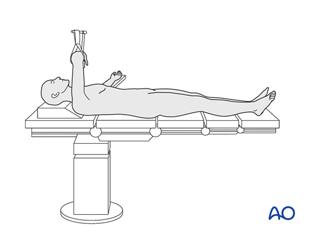 Patient positioning 1 - Supine position 