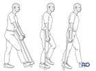 Mobilization with crutches of hip fracture patients
