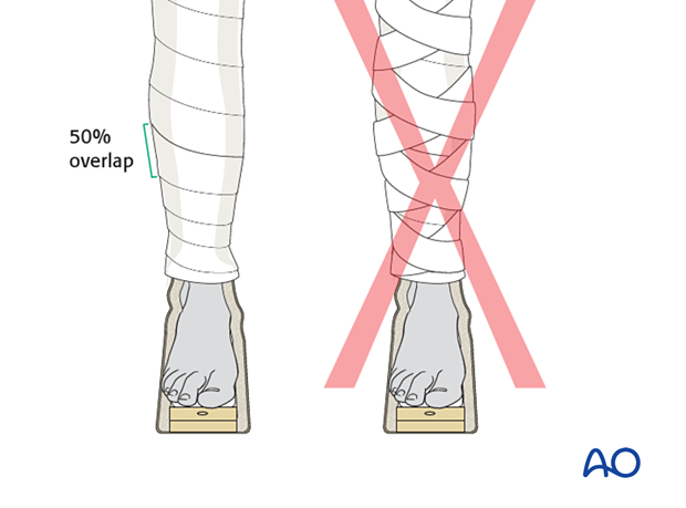 Inelastic bandage wrapping around the limb from just above the malleoli to the top of the skin-traction strip, applying overlying bandages spirally, overlapping by half