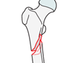Oblique