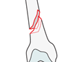 Oblique