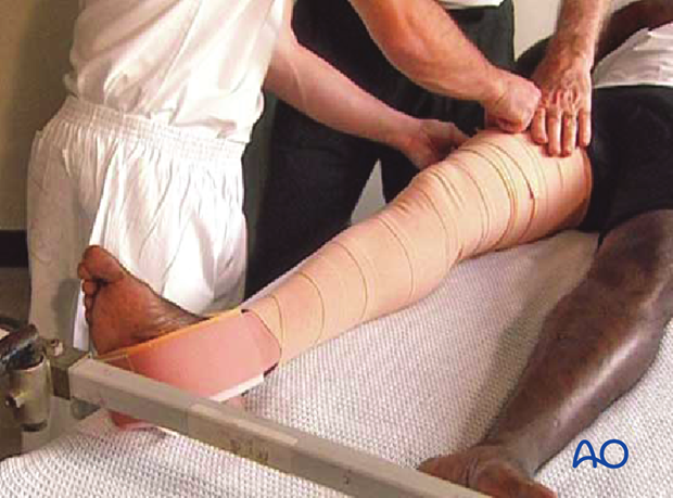 Application of spiral inelastic bandage