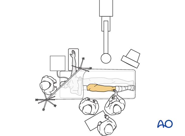 Supine position with manual traction