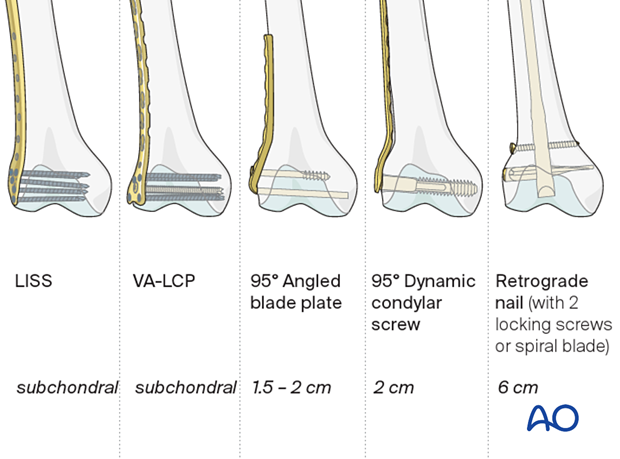 Various implant types
