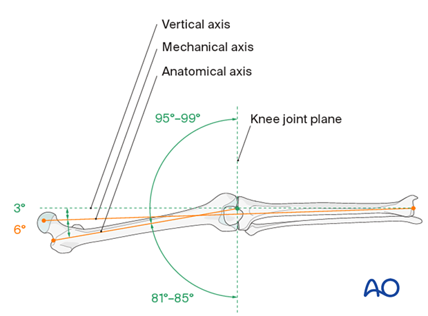 This illustration shows the longitudinal axes of the lower limb