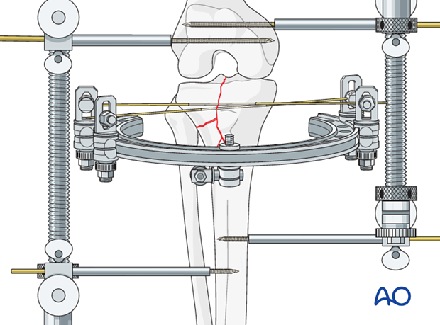 Connect wires with ring.