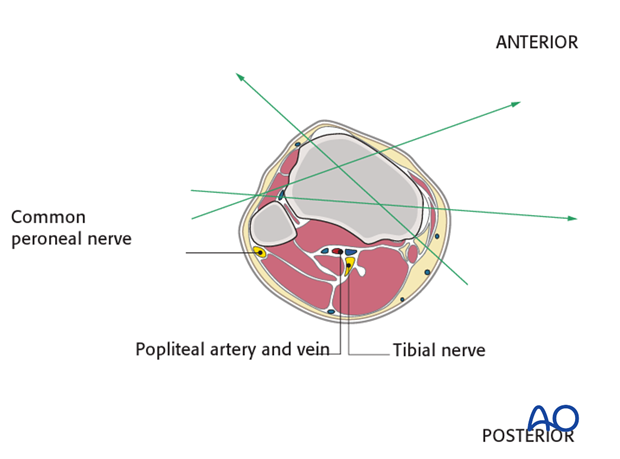 posterior tibial artery cross section