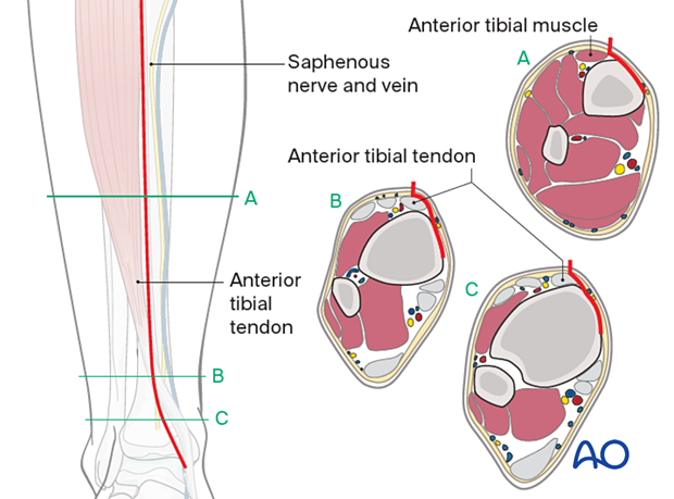 42_A020_i020 Saphenous nerve and vein and anterior tibial tendon
