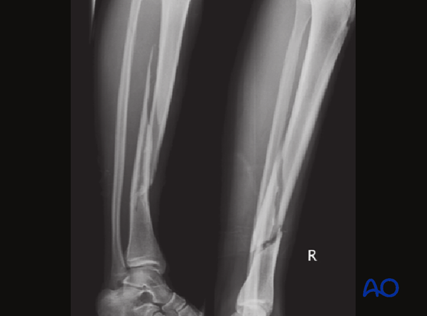 42_P050_Main_i660 42_P050_i660