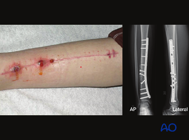 42_P050_Main_i680 42_P050_i680