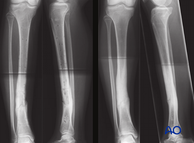 42_P050_Main_i720 42_P050_i720