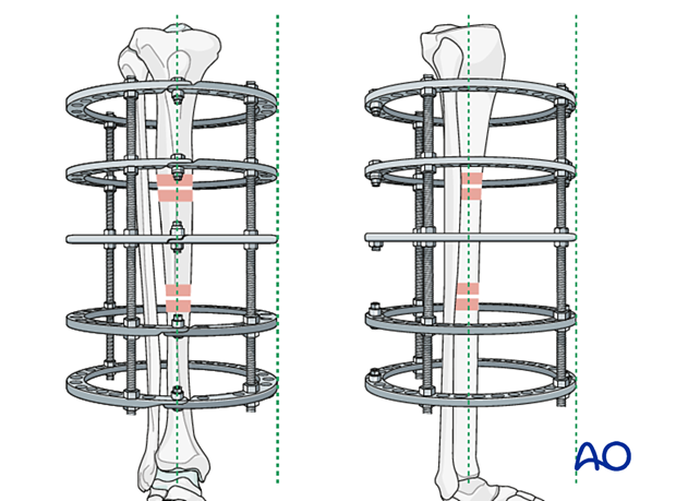 42_P050C2_Intact_Segmental_i160
