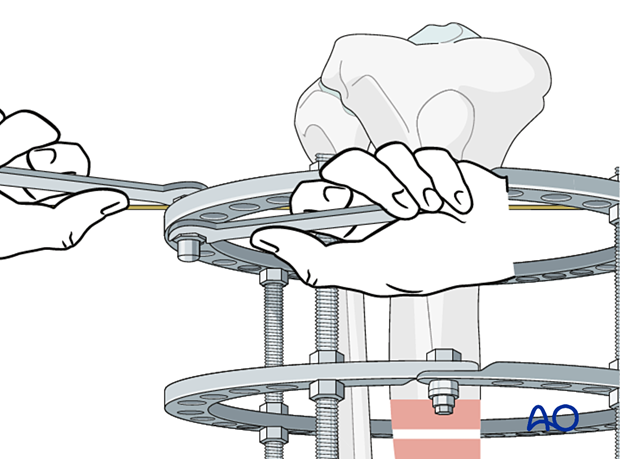 42_P050C2_Intact_Segmental_i220