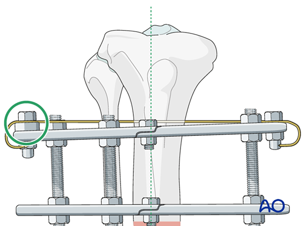 42_P050C2_Intact_Segmental_i340