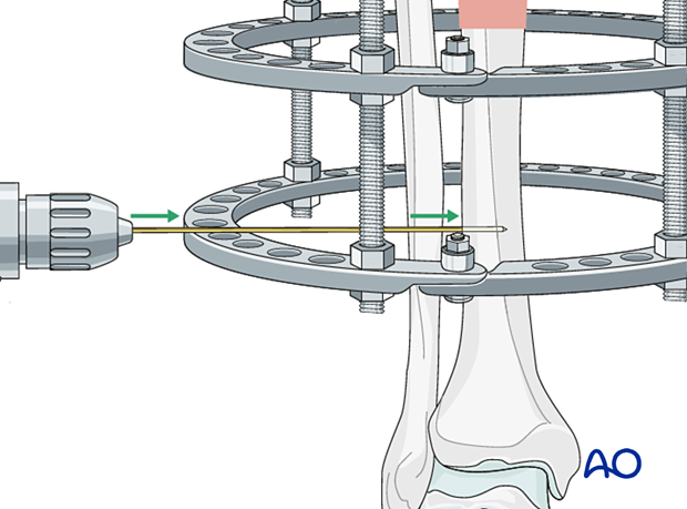 42_P050C2_Intact_Segmental_i380