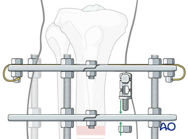 42_P050C2_Intact_Segmental_i480