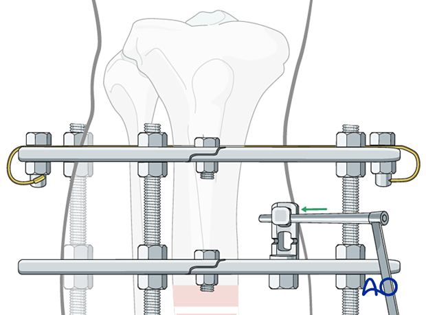 42_P050C2_Intact_Segmental_i500