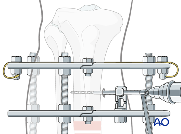 42_P050C2_Intact_Segmental_i580