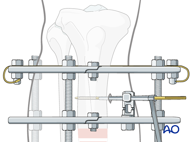 42_P050C2_Intact_Segmental_i600