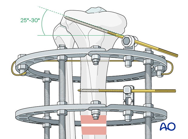 42_P050C2_Intact_Segmental_i640