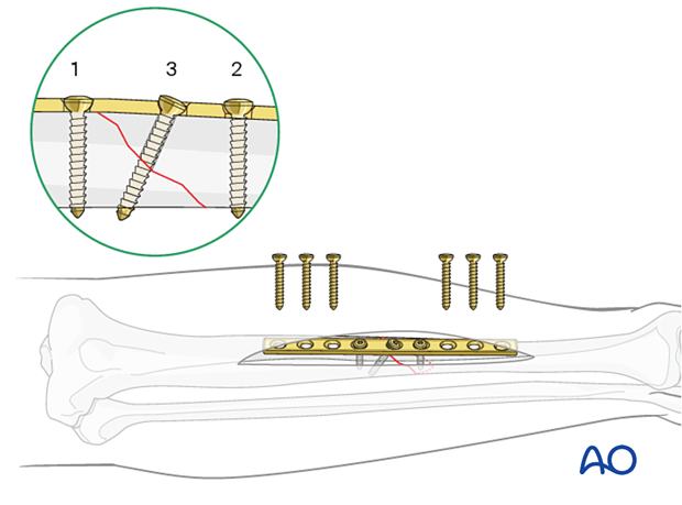 Plate selection and preparation