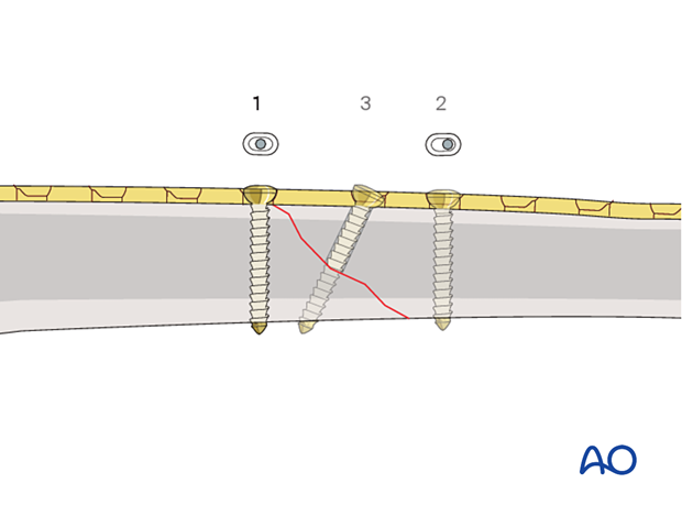 Planning plate position