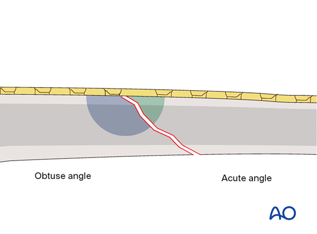 Planning the first screw