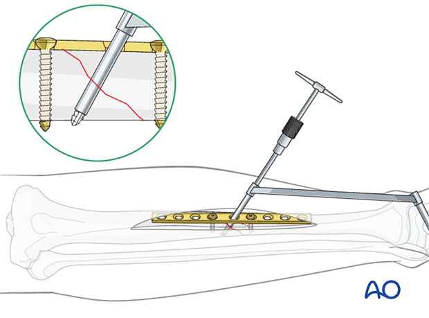 Tapping the thread hole