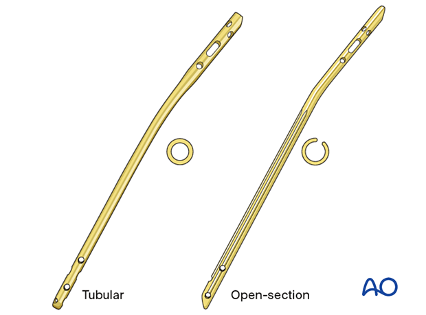 Lateral parapatellar intramedullary nailing of the tibial shaft