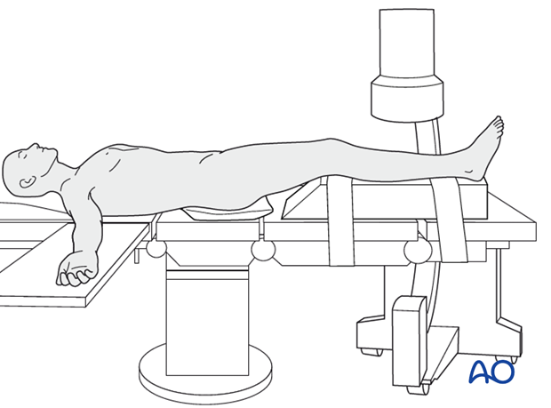 Supine position with C-arm