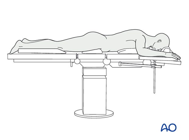 Prone position