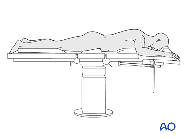 42_Pr010_i010 Prone position