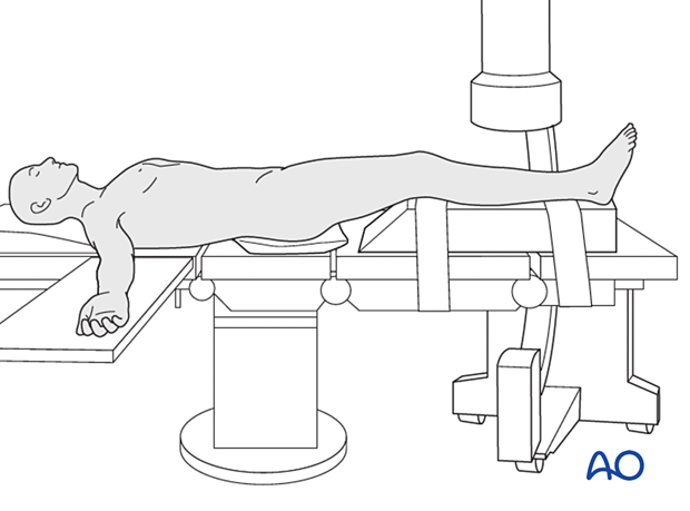 42_Pr020_i030 Supine position with C-arm