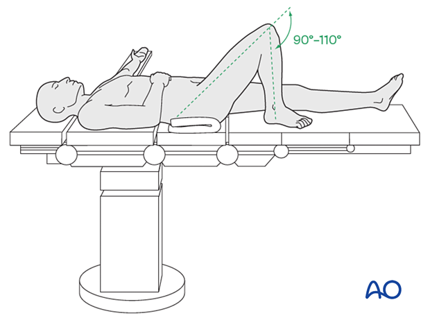 supine position for nailing