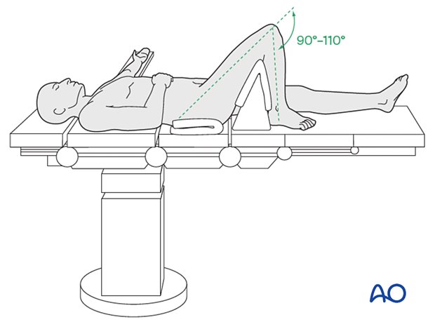 42_Pr030_i020 supine position for nailing