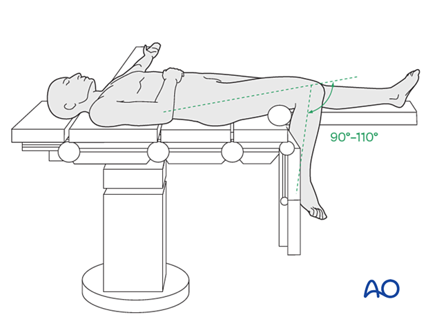 42_Pr030_i030 supine position for nailing