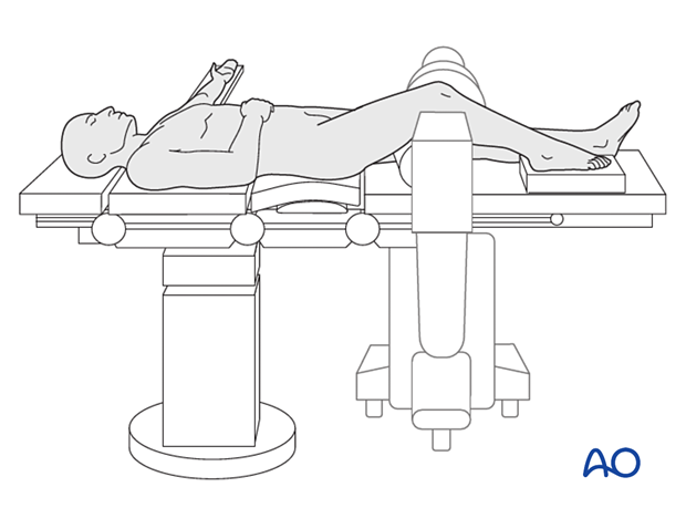 42_Pr050_i020 supine position