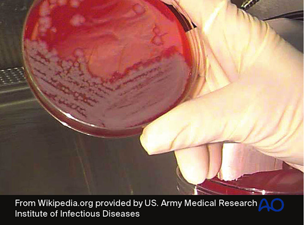 Infecting microorganisms should be identified, their antibiotic sensitivities defined, and appropriate specific antibiotics ...