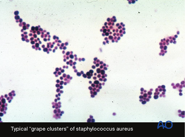 delayed presentation of infection